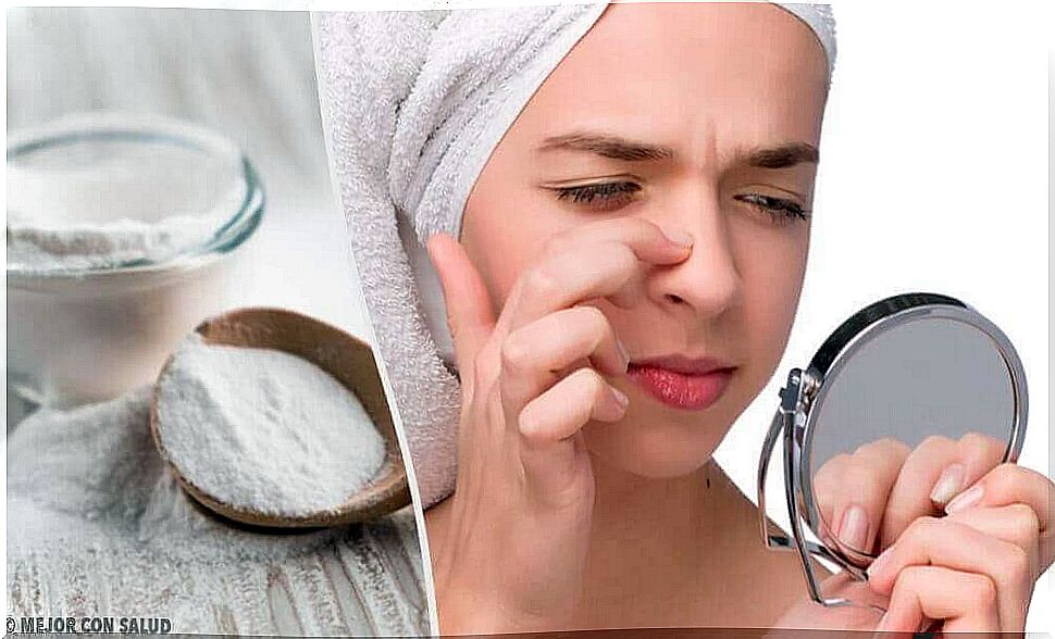 4 masks of baking soda to remove blackheads