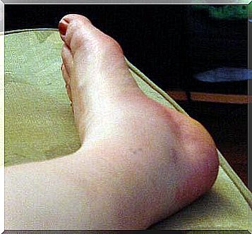 5 problems that swollen ankles can report