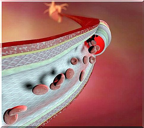 Weak blood vessels