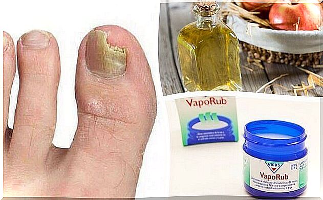 6 tricks to get rid of nail fungus