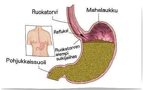 signs of liver poisoning: reflux disease