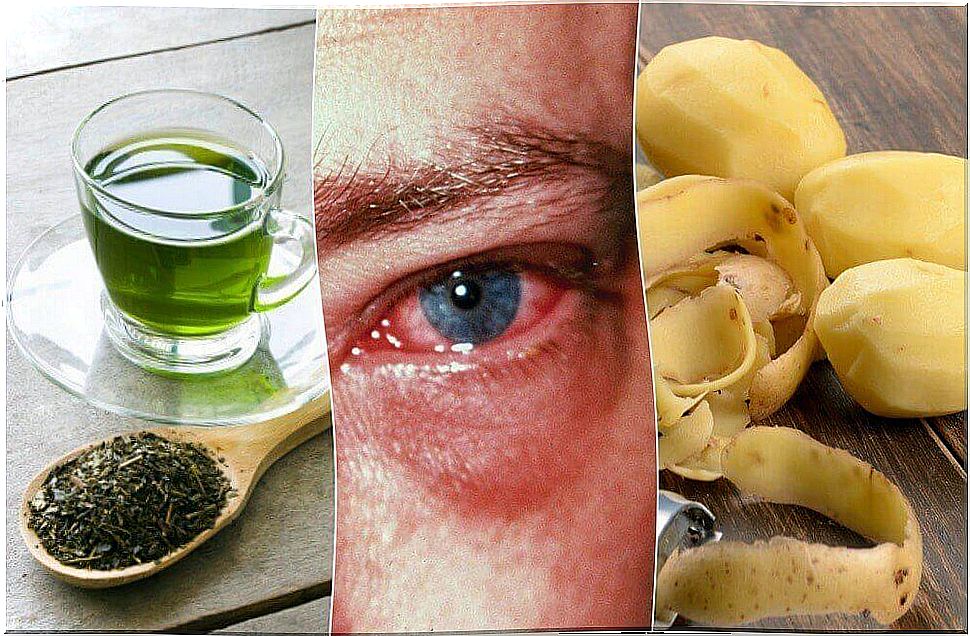 8 best home remedies for eye inflammation