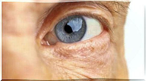 The causes of age-related macular degeneration are still unknown