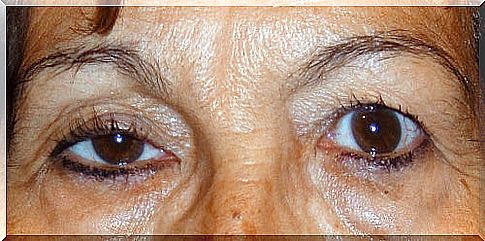 Dangling eyelids - what's the help?