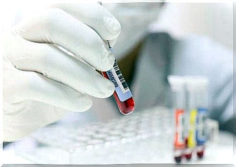 The blood test may show a low number of granule cells