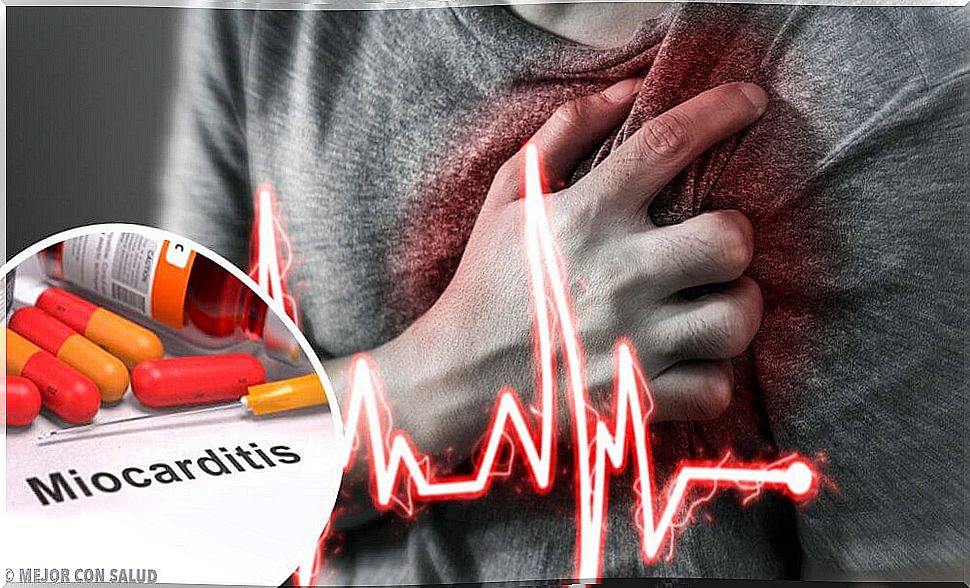 Myocarditis: Causes, Symptoms and Treatment