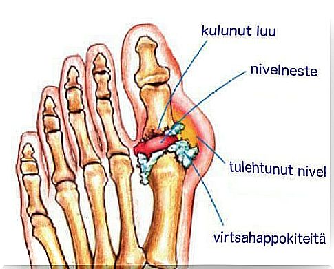 A natural drink to treat gout