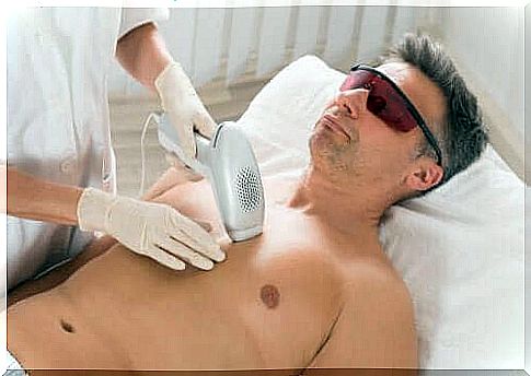 hair removal methods: laser