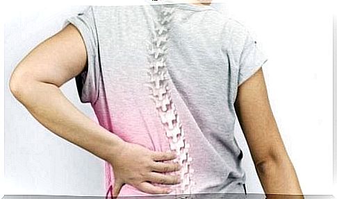 Scoliosis is a problem for many women