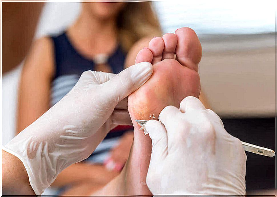 The best ways to treat your nails in your feet