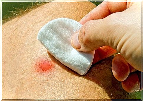 Treatment of abscesses