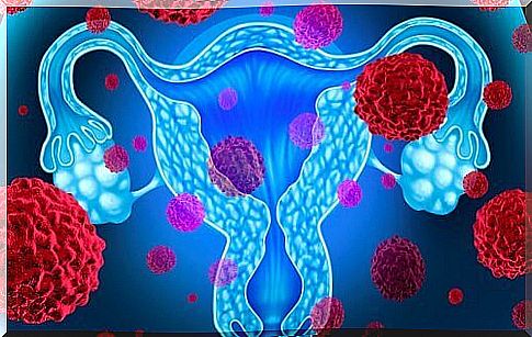 Uterine Cancer: Keep these 5 things in mind