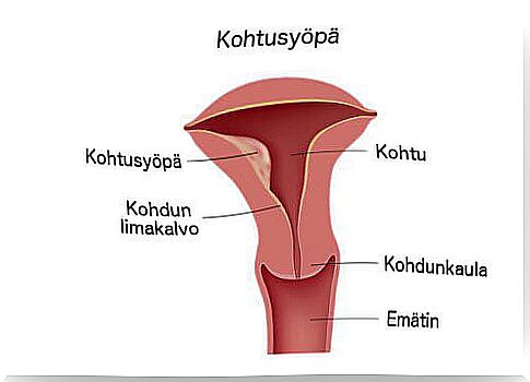 Uterine cancer